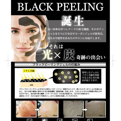 1ブラックピーリング